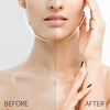 Invisible Face Lift Tape